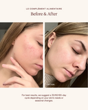 Before and after comparison of a person's face with visible skin improvement.